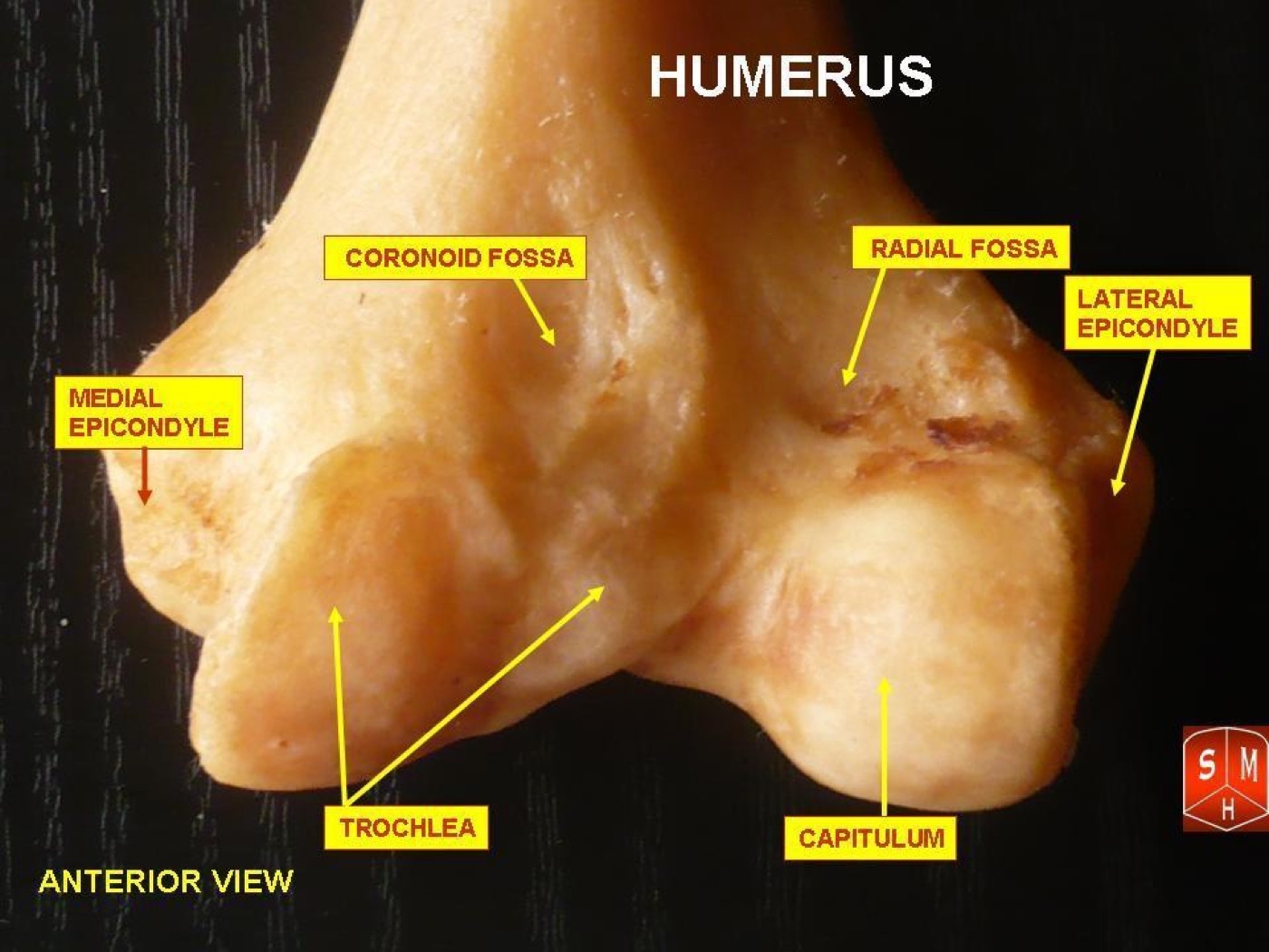 Figure 20. Anterior view of the distal humerus showing the medial and lateral columns and epicondyles, the trochlea and the capitulum. Anatomist90, CC BY-SA 3.0, via Wikimedia Commons.