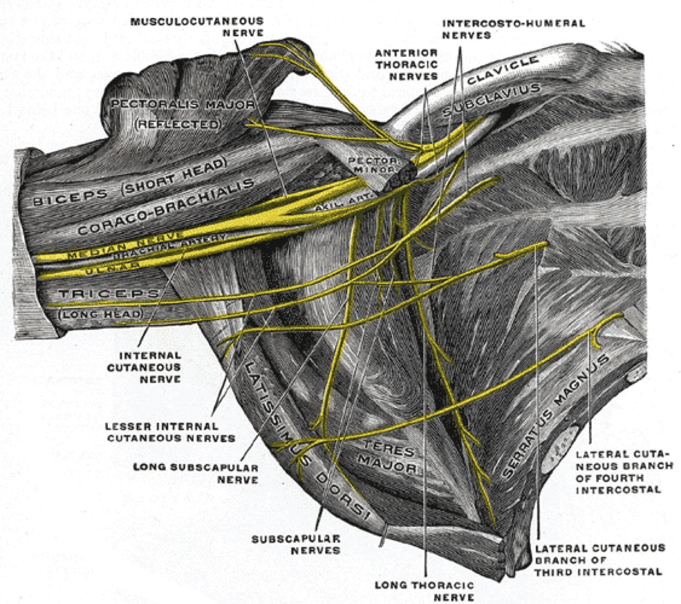 Figure 8. The infraclavicular brachial plexus in the axilla, showing the musculocutaneous nerve running toward coracobrachialis and biceps, the median nerve with the brachial artery, and the ulnar nerve. Gray’s Anatomy plate 809 (public domain), via Wikimedia Commons.