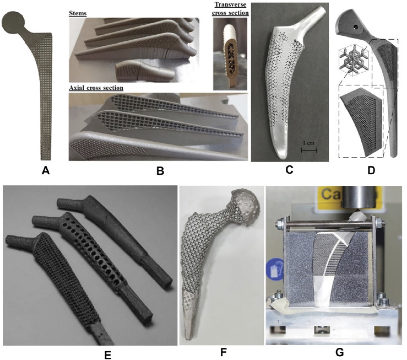 Figure 9. Cementless femoral stems with porous lattice (trabecular-metal) structures and cross-sections showing the internal porous architecture for bone ingrowth. From Liu et al. (2021), Front Bioeng Biotechnol 9:772539, PMC8637819, Fig. 3, CC BY 4.0.
