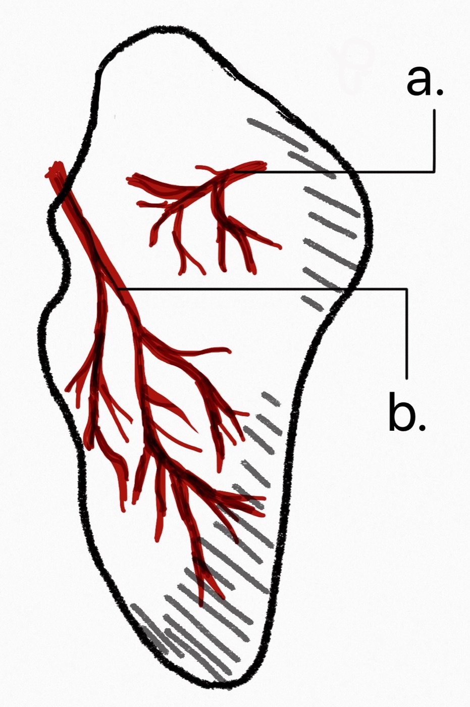 Figure 4. The retrograde blood supply of the scaphoid: the dorsal branch of the radial artery enters distally and supplies the proximal pole, which is therefore prone to avascular necrosis. Iiibalesiii, CC BY-SA 4.0, via Wikimedia Commons.