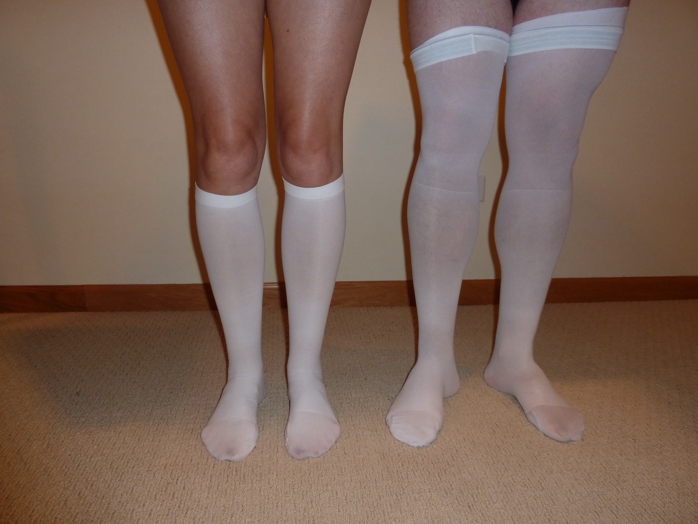 Figure 8. Graduated (anti-embolism, TED) compression stockings. Source: Lentpjuve, via Wikimedia Commons, CC BY-SA 4.0.