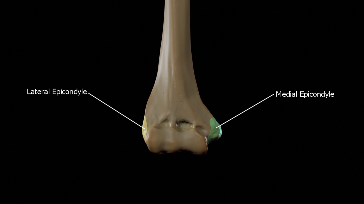 Figure 12. Distal humerus (anterior view) with the medial and lateral epicondyles and the two columns highlighted. Doctor Jana, CC BY-SA 4.0, via Wikimedia Commons.