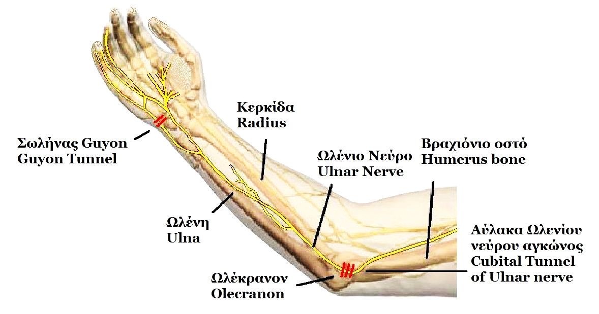 Figure 17. Course of the ulnar nerve behind the medial epicondyle through the cubital tunnel and down the forearm to Guyon’s canal. Dr Harry Gouvas (public domain), via Wikimedia Commons.