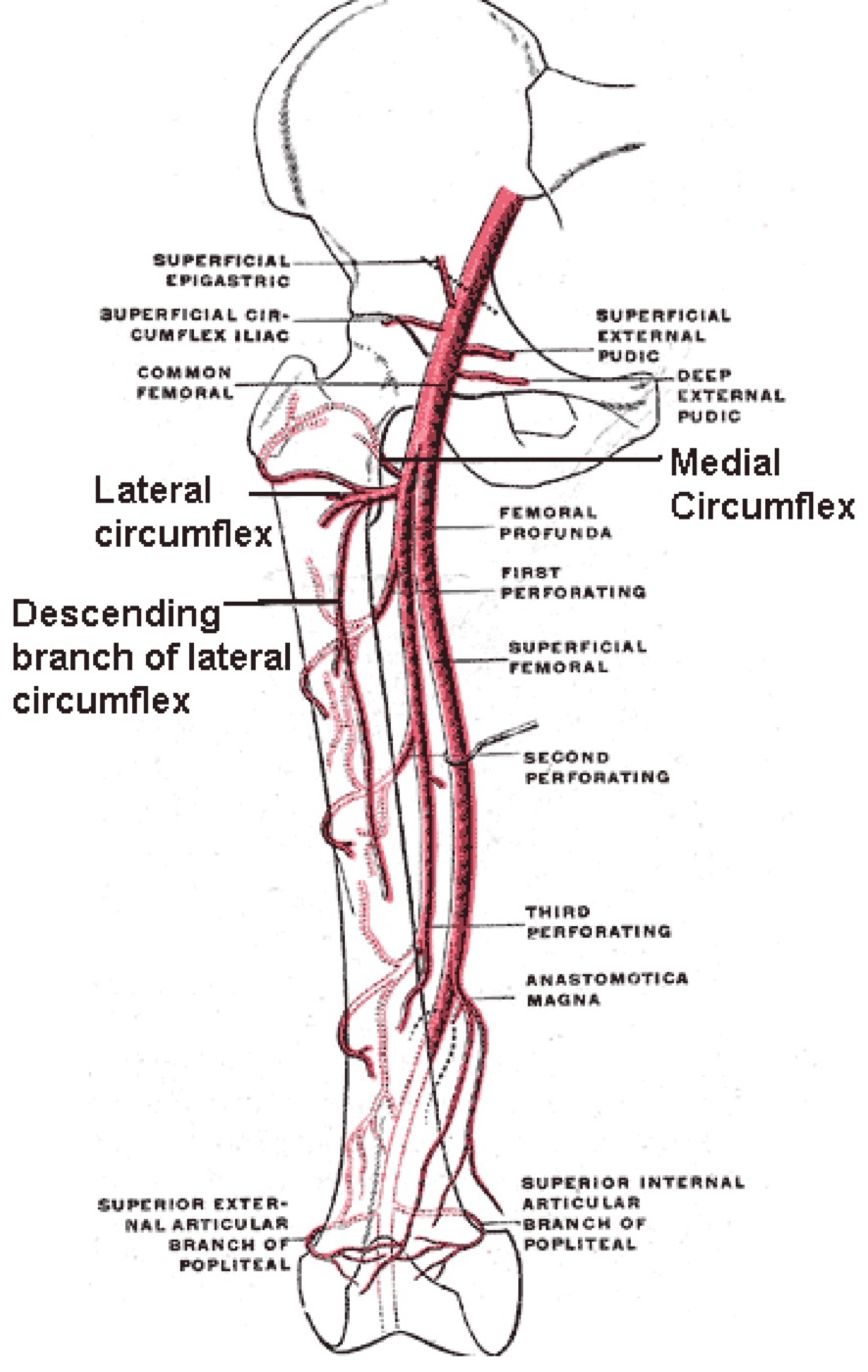 Figure 1. The femoral circumflex arteries: the medial femoral circumflex (dominant) gives the retinacular vessels that supply the femoral head. Diagram by Mikael Häggström after Gray’s Anatomy, public domain, via Wikimedia Commons.