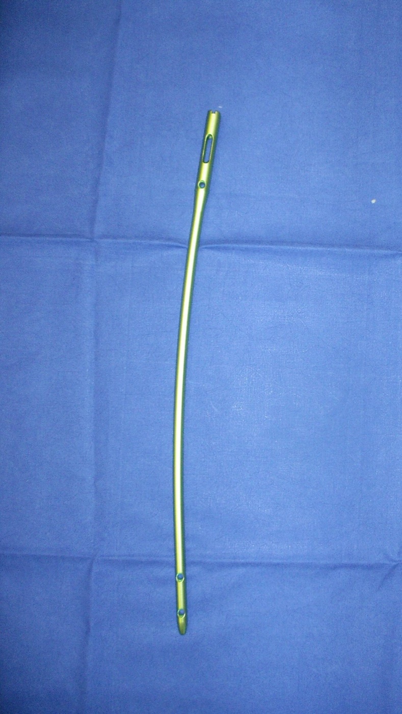Figure 11. An antegrade interlocking intramedullary femoral nail, showing the proximal and distal locking holes and the anterior bow. Image by Hentsch, public domain, via Wikimedia Commons.