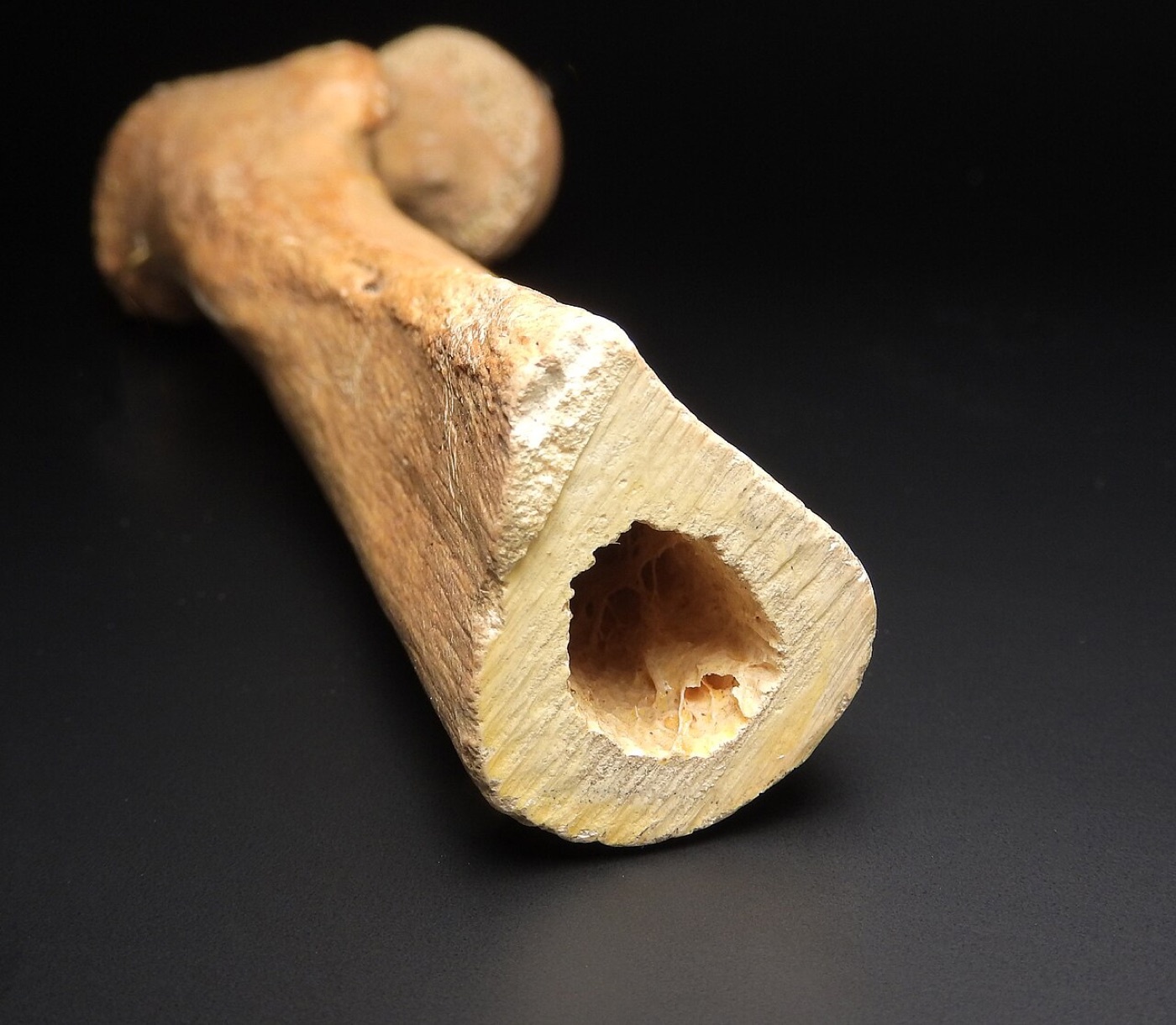 Figure 4. Cross-section through the femoral diaphysis showing the thick cortical wall and the central medullary canal that an intramedullary nail occupies. Image by MAKY.OREL, CC0, via Wikimedia Commons.