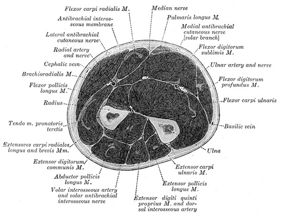Figure 1. Transverse section of the mid-forearm showing the volar (flexor) and dorsal (extensor) compartments separated by the radius, ulna and interosseous membrane, with the radial, ulnar, median and anterior interosseous neurovascular bundles. Gray’s Anatomy plate 417 (public domain), via Wikimedia Commons.