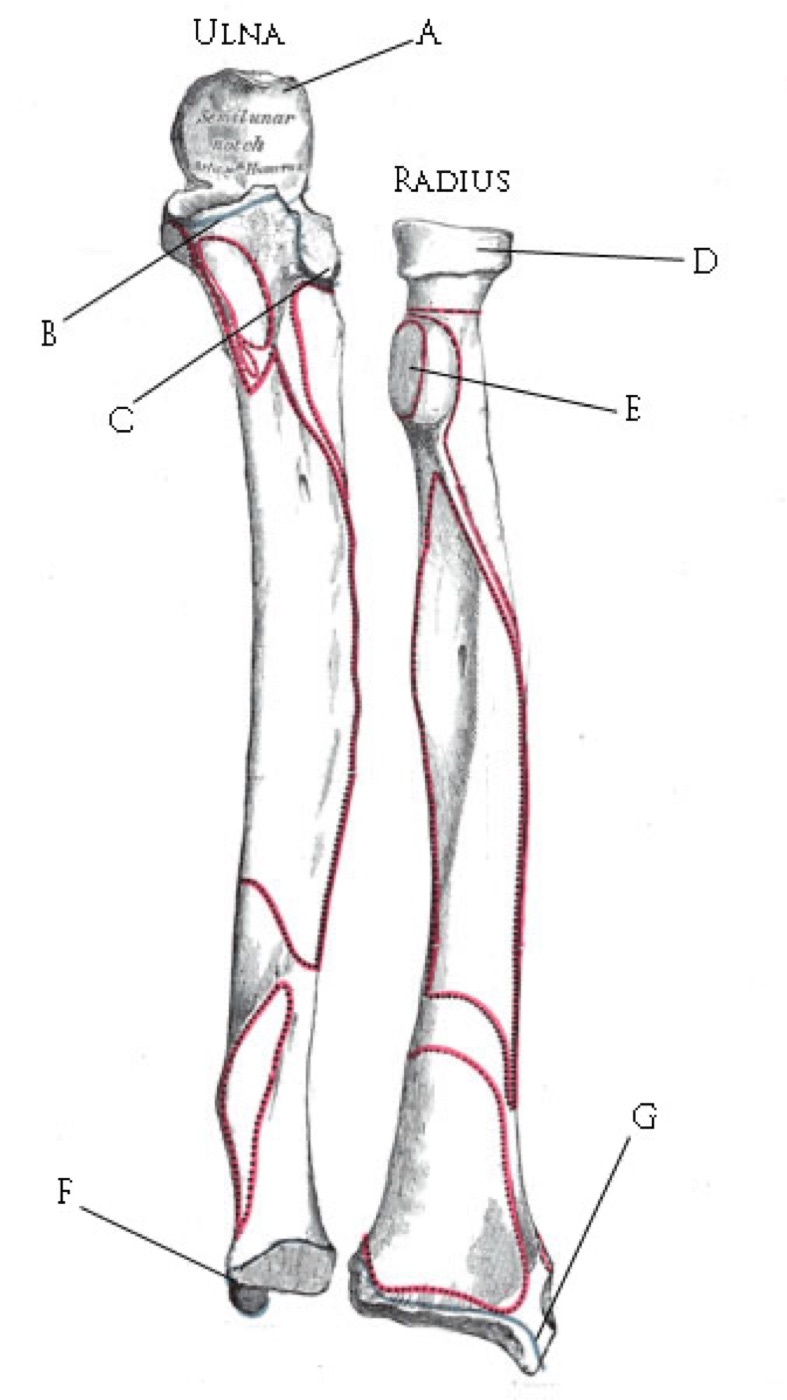 Figure 3. The radius and the ulna: the laterally bowed radius rotates about the straight ulna, the anatomical basis of pronation and supination. Illustration by Rafael Di Marco Barros after Gray’s Anatomy, public domain, via Wikimedia Commons.