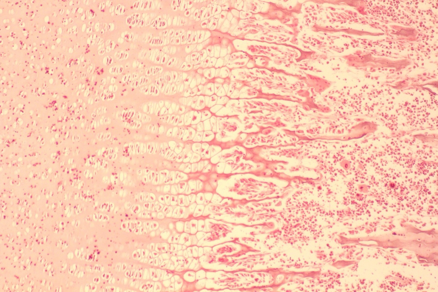 Figure 5. Endochondral ossification: resting/proliferating cartilage (left), hypertrophic cartilage (middle), and new cancellous bone (right). Source: Patbio, via Wikimedia Commons, CC BY-SA 4.0.