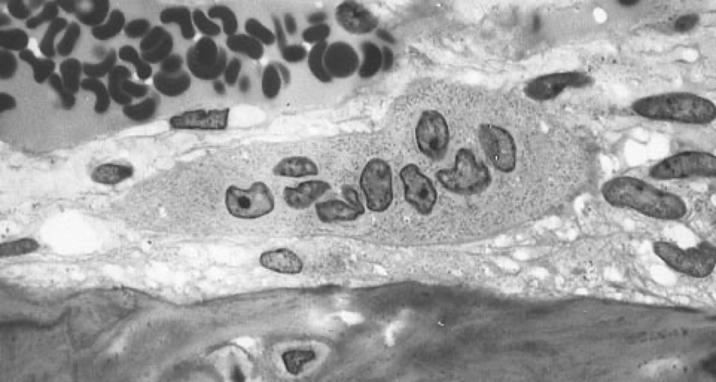 Figure 6. A multinucleated osteoclast on a bone surface (the bone-resorbing cell). Source: Robert M. Hunt, via Wikimedia Commons, public domain.