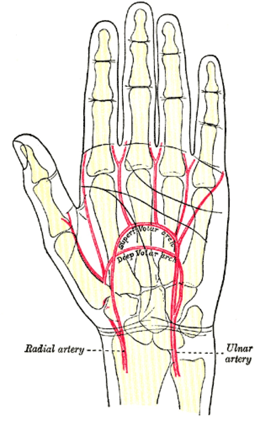 Figure 1. Surface markings and flexion creases of the palm and wrist, the landmarks that govern incision placement (a flexion crease must not be crossed at a right angle). Gray’s Anatomy plate 1237 (public domain), via Wikimedia Commons.