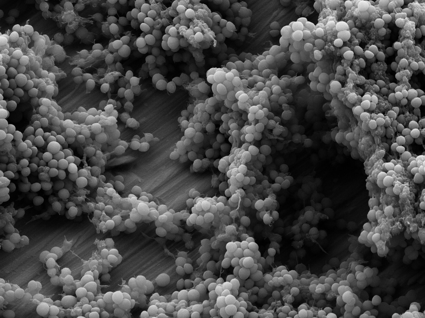 Figure 1. Scanning electron micrograph of a Staphylococcus epidermidis biofilm on a titanium implant surface: clustered cocci embedded in extracellular matrix, the structural basis of antibiotic tolerance. Source: Shahfa84, via Wikimedia Commons, CC BY-SA 4.0.