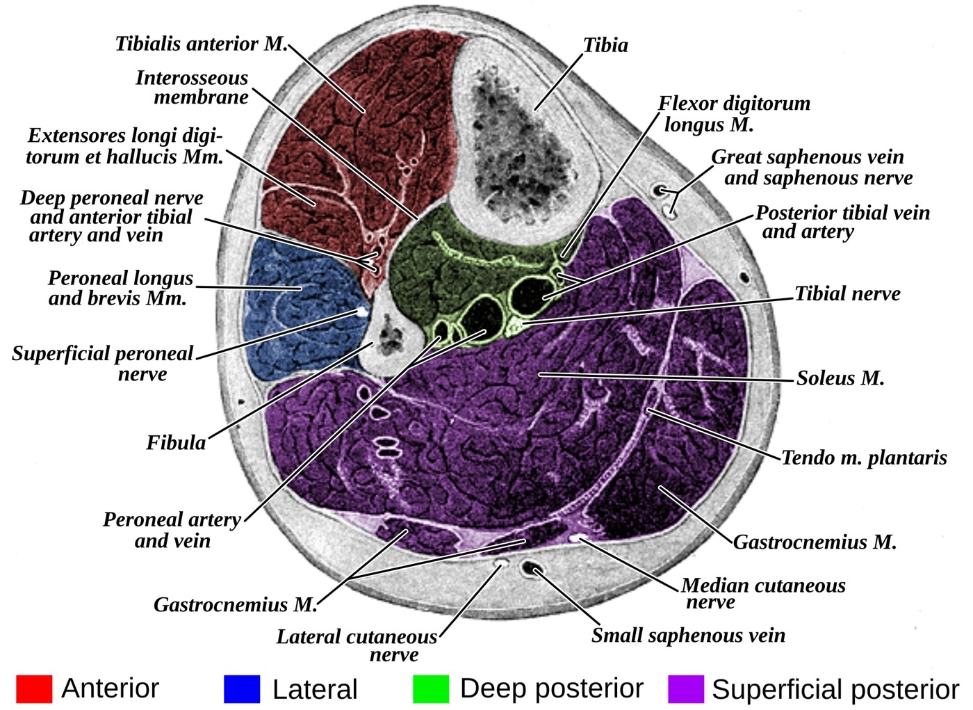 Figure 4. Transverse section through the middle of the leg showing the four fascial compartments (anterior, lateral, superficial and deep posterior, colour-coded), the tibia, fibula and interosseous membrane, the intermuscular septa and the neurovascular bundles. Gray’s Anatomy (1918), Plate 440 (colourised derivative), public domain, via Wikimedia Commons.