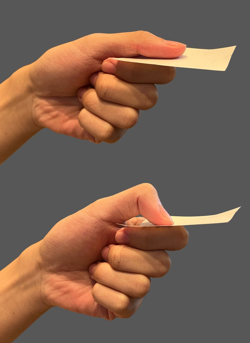 Figure 6. Froment’s sign: a weak adductor pollicis is compensated by flexor pollicis longus, flexing the thumb IP joint during key pinch. Source: Athikhun.suw, via Wikimedia Commons, CC BY-SA 4.0.