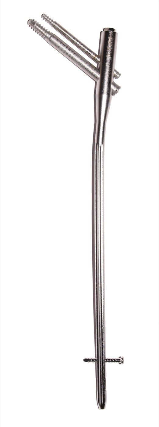 Figure 12. A proximal femoral (cephalomedullary) nail, with cephalic head screws proximally and an interlocking screw distally. Source: Bullenwächter, via Wikimedia Commons, CC BY 3.0.