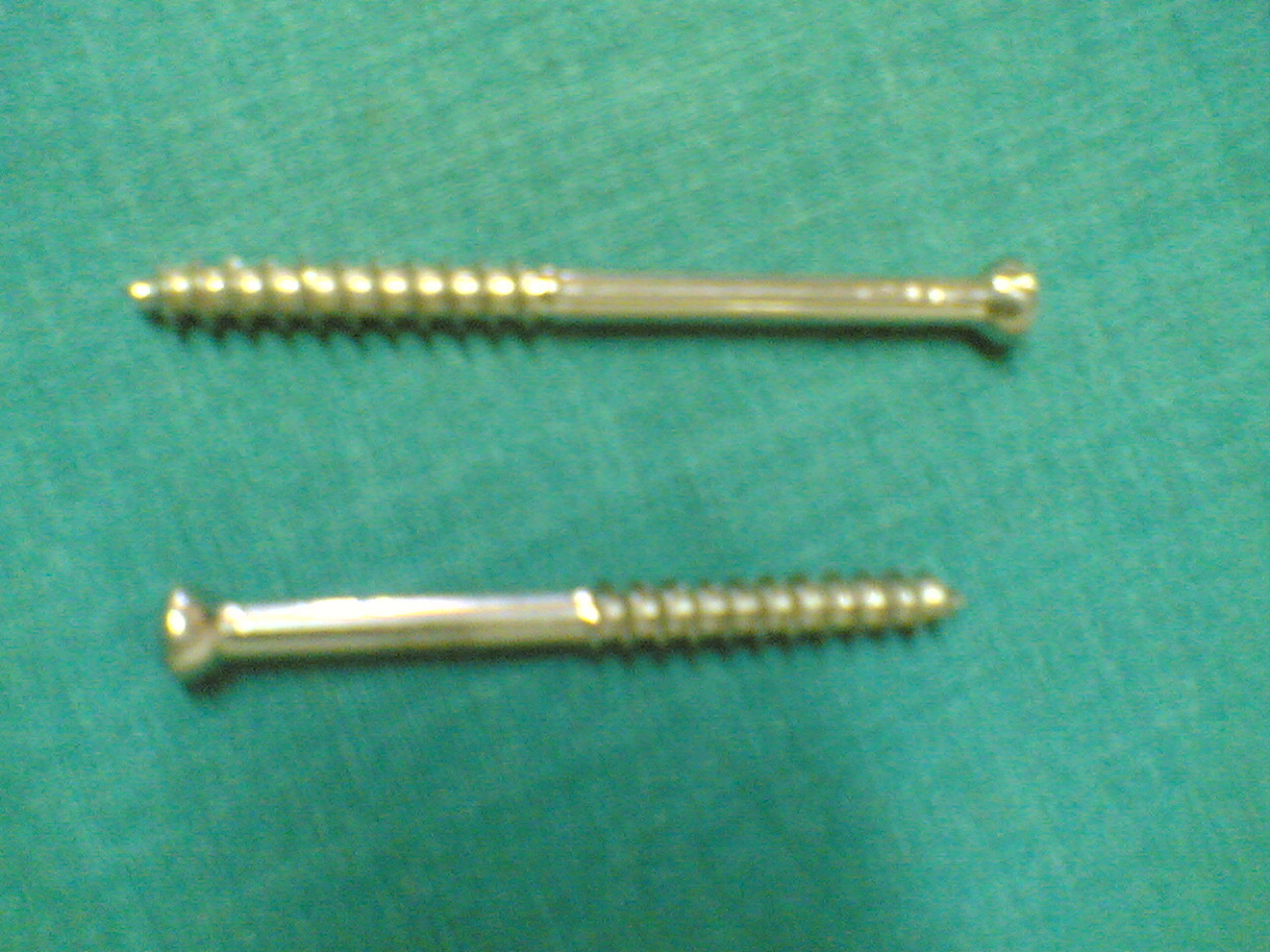 Figure 4. Partially threaded lag screws “by design”: the smooth proximal shank glides through the near fragment while the distal thread grips the far fragment, generating interfragmentary compression. Source: Netha Hussain, via Wikimedia Commons, CC BY-SA 3.0.