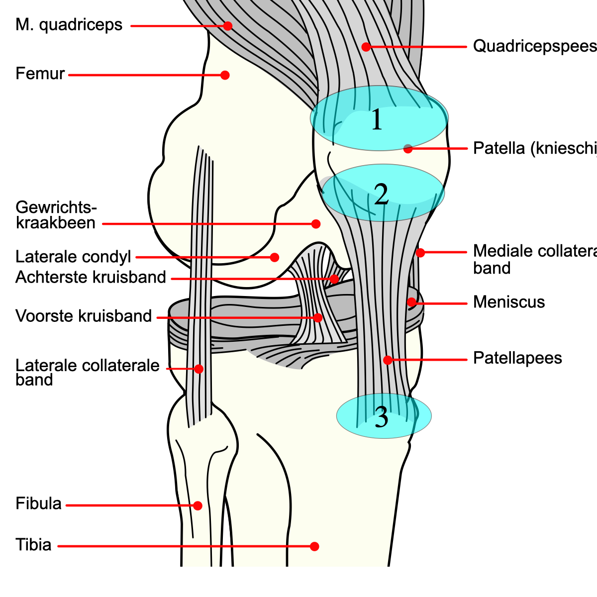 Figure 13. Patellar tendinopathy (“jumper’s knee”): the patellar tendon and the inferior-pole pain zone (diagram labelled in Dutch). Source: Mysid / .Koen, via Wikimedia Commons, CC BY-SA 3.0.