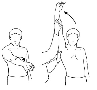 Figure 4. The Neer impingement sign: passive forward flexion of the internally rotated arm drives the greater tuberosity against the anterior acromion. Source: Nasch92, via Wikimedia Commons, CC BY-SA 4.0.