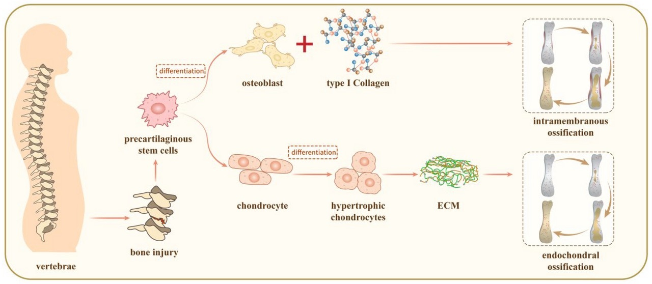 Figure 3. The two ossification pathways: intramembranous (direct) versus endochondral (through a cartilage model). Ge et al., CC BY 4.0, via Wikimedia Commons.