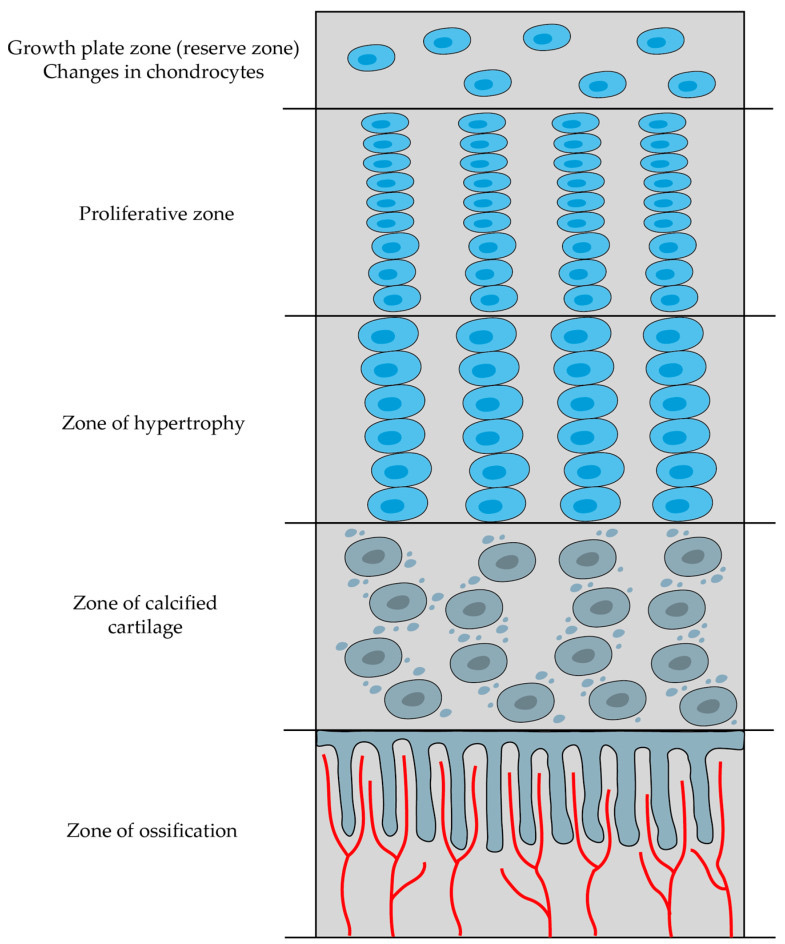 Figure 4. Zones of the growth plate (physis) from epiphysis to metaphysis: resting/reserve, proliferative, hypertrophic, calcified-cartilage and ossification zones, with vascular invasion at the metaphysis. Šromová, Sobola & Kaspar, CC BY 4.0, via Wikimedia Commons.