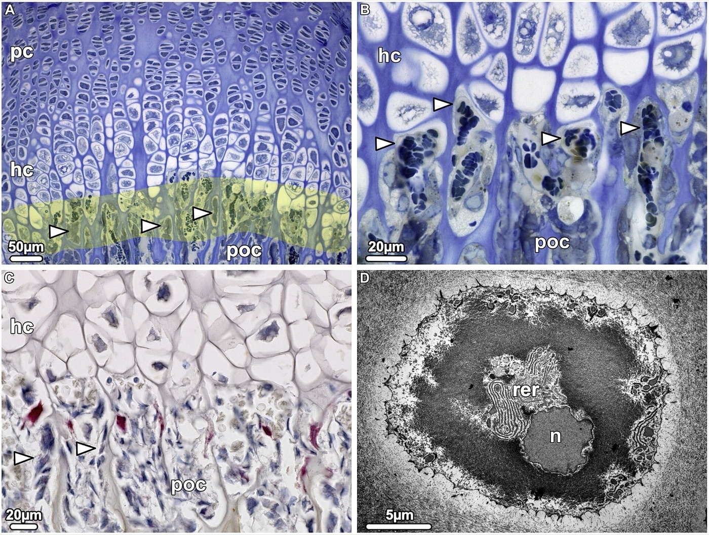 Figure 5. Histology of the epiphyseal growth plate at the chondro-osseous junction: proliferative (pc) and hypertrophic (hc) chondrocyte columns meeting the primary ossification front (poc). Khan, Clifton, Lorenzo, Hansen & Drissi, CC BY 4.0, via Wikimedia Commons.