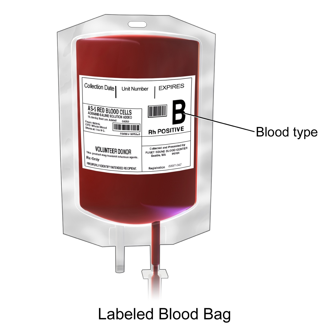 Figure 10. A labelled unit of packed red blood cells for transfusion. Source: BruceBlaus, via Wikimedia Commons, CC BY 3.0.