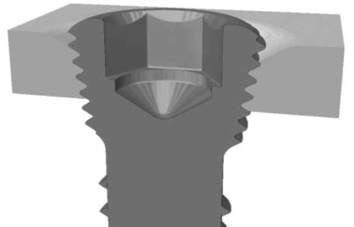 Figure 5. A locking-head screw whose threaded head locks into the threaded plate hole, forming a fixed-angle internal fixator that does not rely on plate-to-bone friction. Source: Karel Frydrýšek, via Wikimedia Commons, CC BY-SA 4.0.