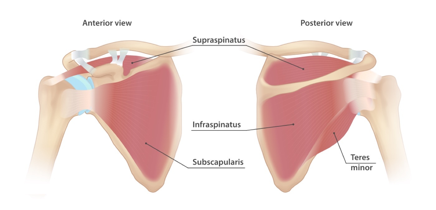Figure 4. The four rotator cuff muscles: subscapularis anteriorly, and supraspinatus, infraspinatus and teres minor posteriorly, forming the inner muscular sleeve of the shoulder. InjuryMap, CC BY-SA 4.0, via Wikimedia Commons.