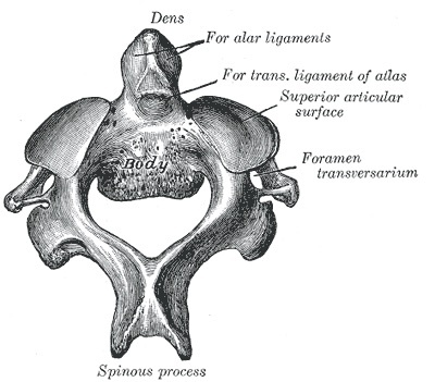 Figure 5. The axis (C2), showing the odontoid process (dens) with its facets for the alar and transverse ligaments. Gray’s Anatomy (1918), public domain, via Wikimedia Commons.