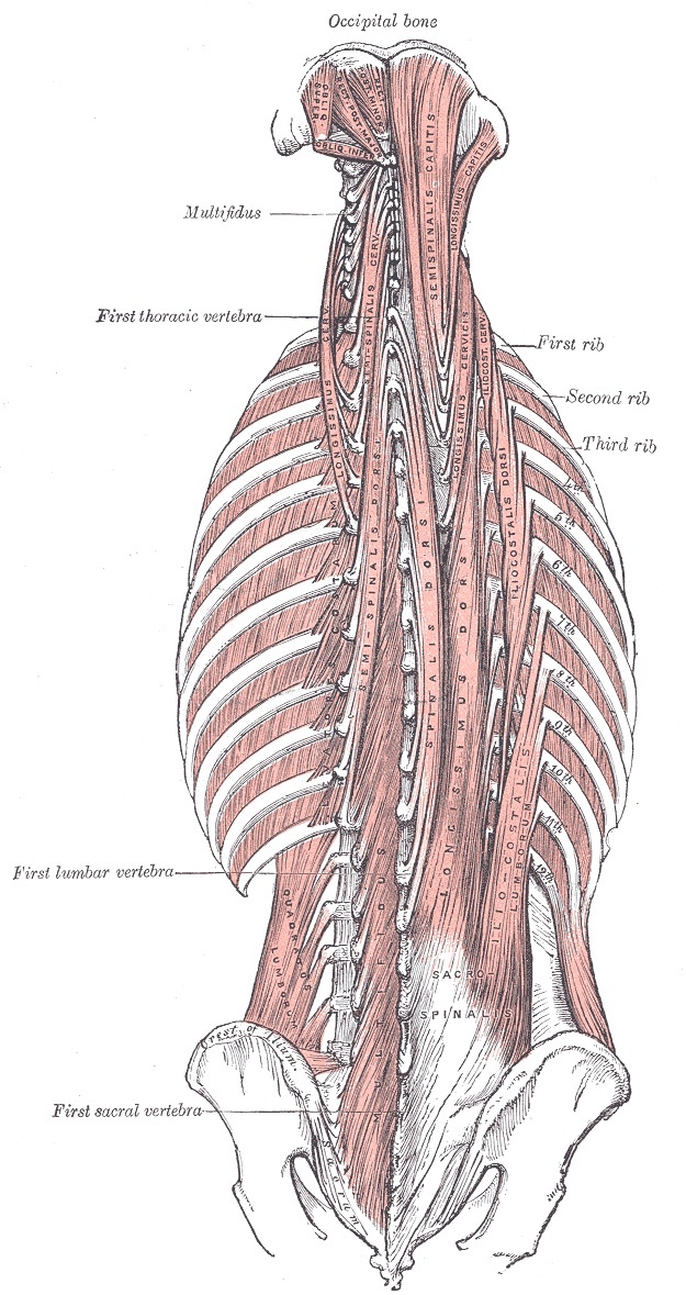 Figure 12. The deep paraspinal musculature of the posterior trunk: the erector spinae (iliocostalis, longissimus, spinalis), semispinalis and multifidus. The posterior midline approach strips these segmentally innervated muscles off the posterior elements. Gray’s Anatomy (1918), public domain, via Wikimedia Commons.