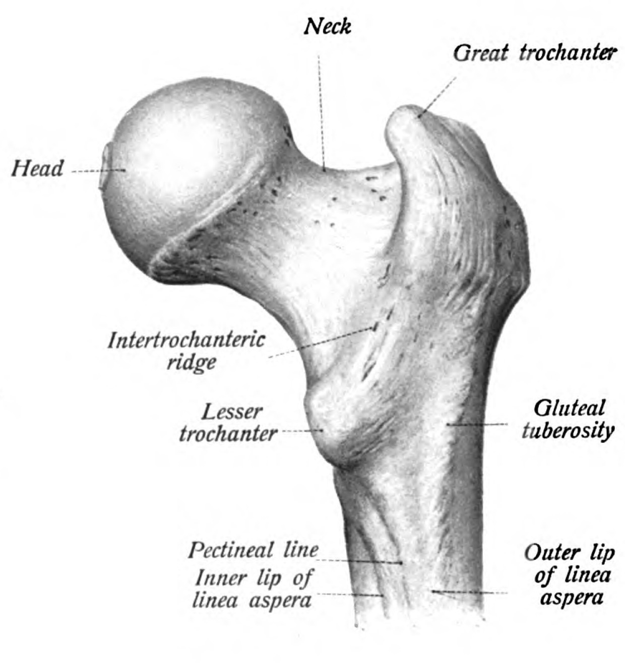 Figure 1. Proximal femur anatomy - head, neck, greater and lesser trochanters, and the subtrochanteric region (the proximal shaft distal to the lesser trochanter). From Sobotta’s Atlas of Human Anatomy (1909), public domain, via Wikimedia Commons.