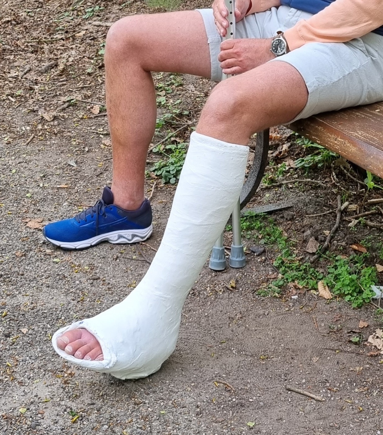 Figure 10. Below-knee (short-leg) walking cast with a toeplate, the form of functional weight-bearing immobilisation. Image by Jonuscumgi, CC BY-SA 4.0, via Wikimedia Commons.
