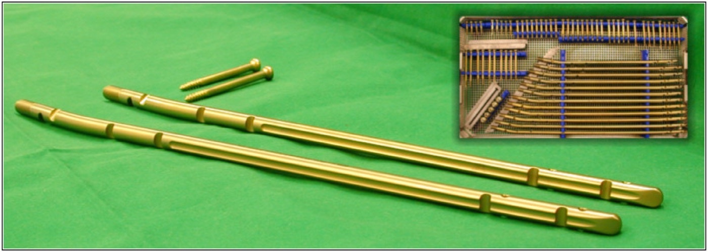 Figure 12. Intramedullary nails with their locking screws (implant hardware). Image by Chriudel, CC BY-SA 3.0, via Wikimedia Commons.