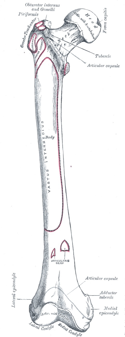 Figure 1. The proximal femur: head, neck, greater and lesser trochanters (the calcar lies along the posteromedial neck). Henry Vandyke Carter, Gray’s Anatomy (1918), public domain, via Wikimedia Commons.